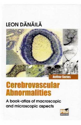 Cerebrovascular abnormalities - Leon Danaila - Carti Medicina - Medicale