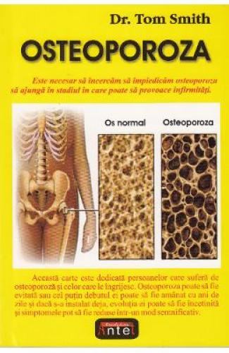 Osteoporoza - Tom Smith -  Sanatate - Medicina pentru toti